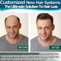 Customize New Hair Replacements Man Toupees [CUSTOM]